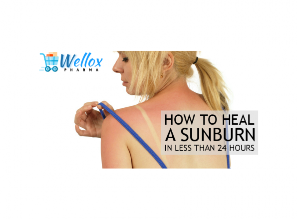 Effective Ways To Deal With Sunburn